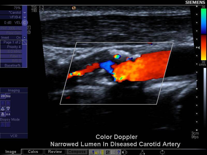 Vascular check
